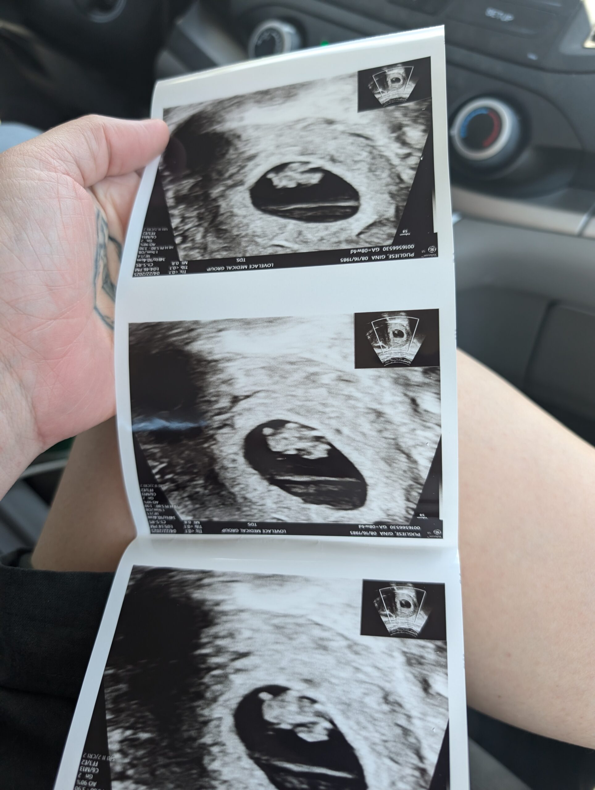 I Wouldn’t Die to Have a Baby